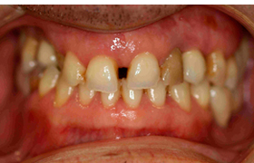 Estética antes 1
