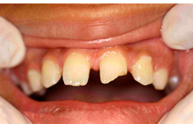 Odontologia antes