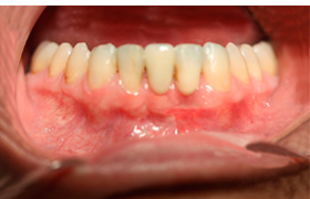 Periodoncia despues