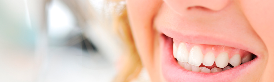 Estetica dental
